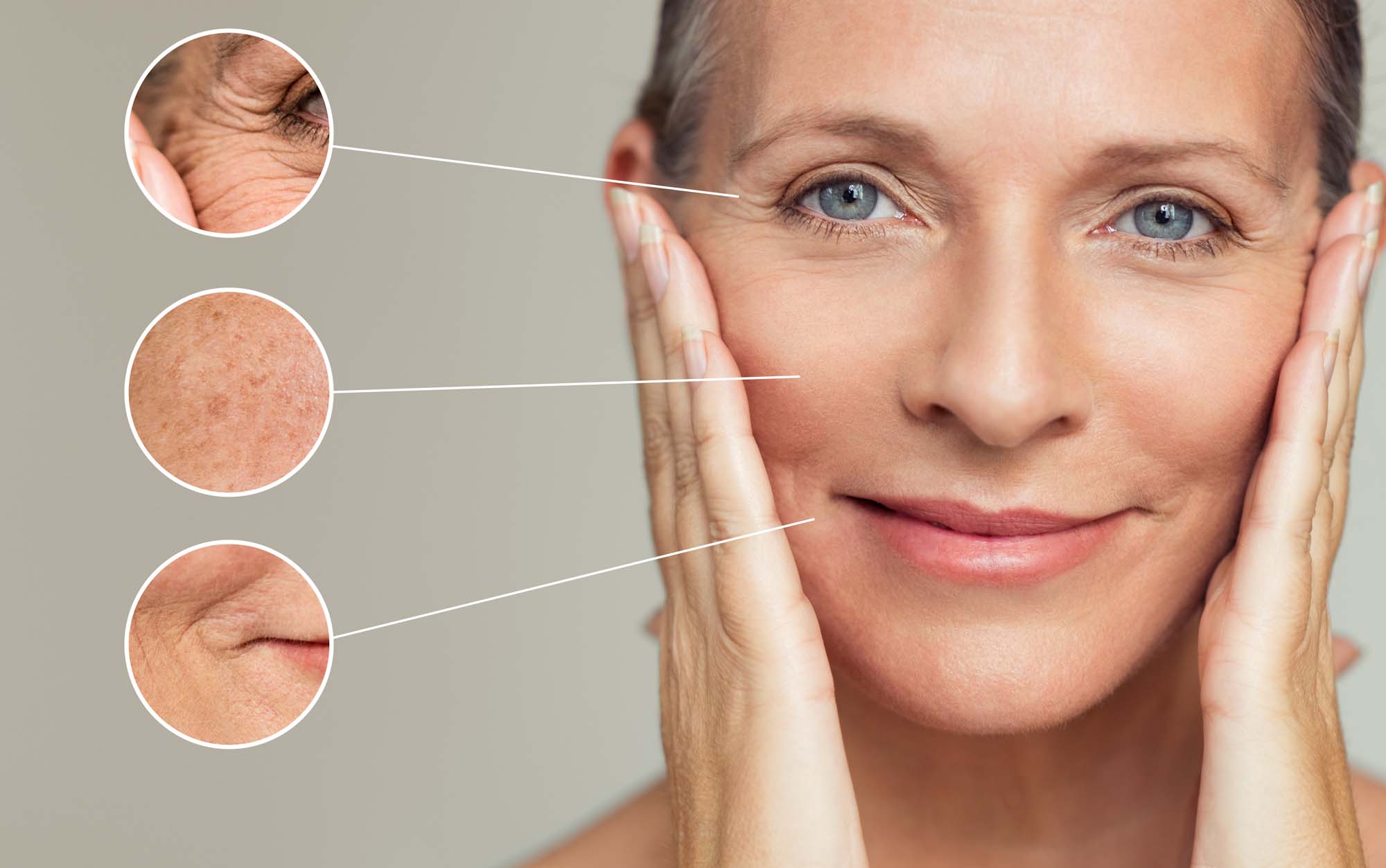 Fine Lines & Wrinkle Treatment - Complete Skin Solutions Rockhampton
